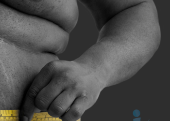 Estudo avalia substituir os termos que classificam obesidade