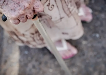 Taxas de mortalidade de idosos 80+ por desnutrição permanecem elevadas