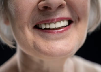 Dentes também envelhecem: veja o que acontece e o que pode ser feito para reverter o sorriso cansado