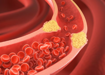 Qual é a diferença entre colesterol bom e ruim? Veja como mantê-los em níveis saudáveis