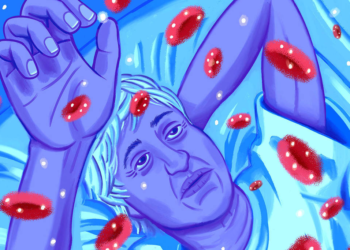 Sintomas de anemia podem ser confundidos com sinais de envelhecimento