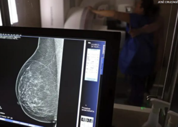 Outubro Rosa: diagnóstico precoce ganha reforço com mamografia a partir dos 40 anos