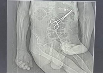 Família acusa hospital de esquecer pinça em corpo de idoso morto na véspera do Natal em MG