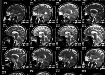 Pela 1ª vez, cientistas mapeiam como o cérebro envelhece em cada região; entenda
