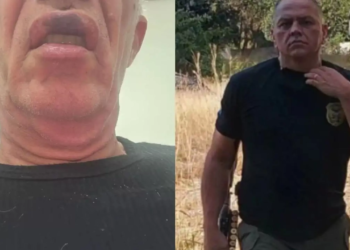 Casal de idosos avalia mudar de cidade após agressão de policial em elevador de condomínio