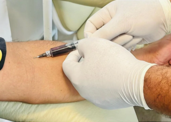 Médico alerta para sinais de anemia em idosos e reforça importância do diagnóstico precoce