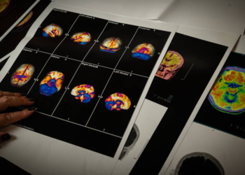 Cinco mudanças de hábito retardam declínio cognitivo em idosos, mostra estudo latino-americano